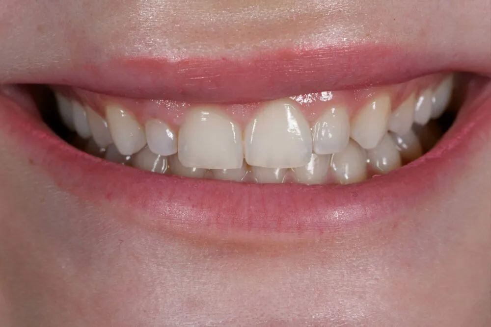 Before cosmetic treatment